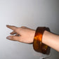 PULSERA ACIDS